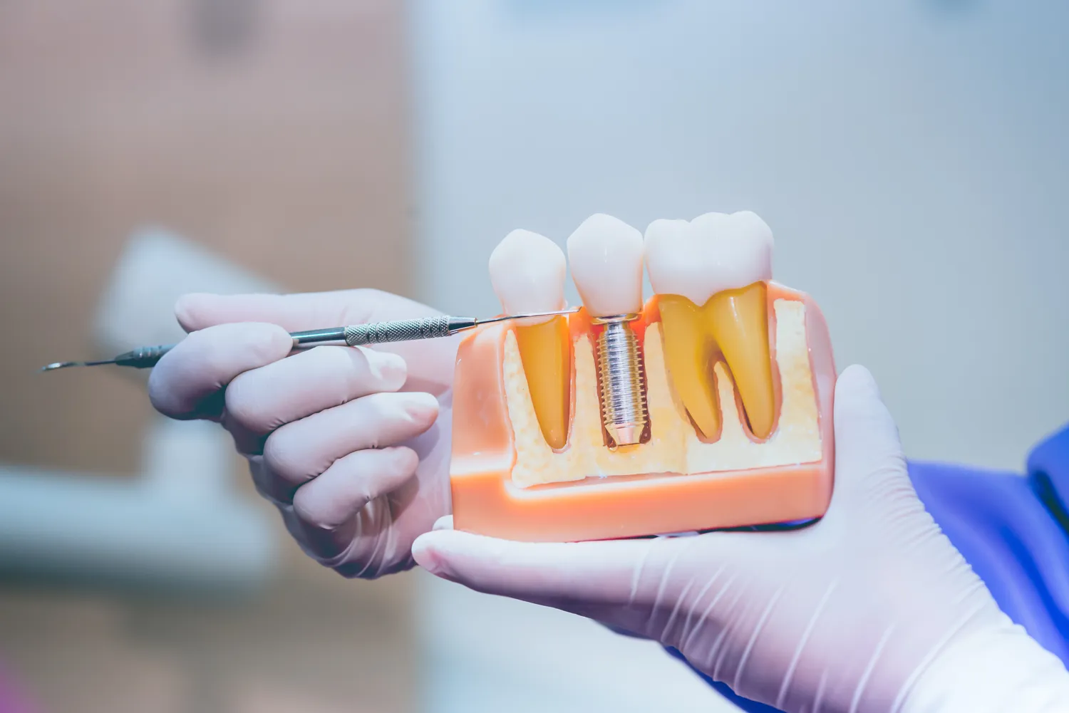 Zabiegi dentystyczne refundowane przez NFZ