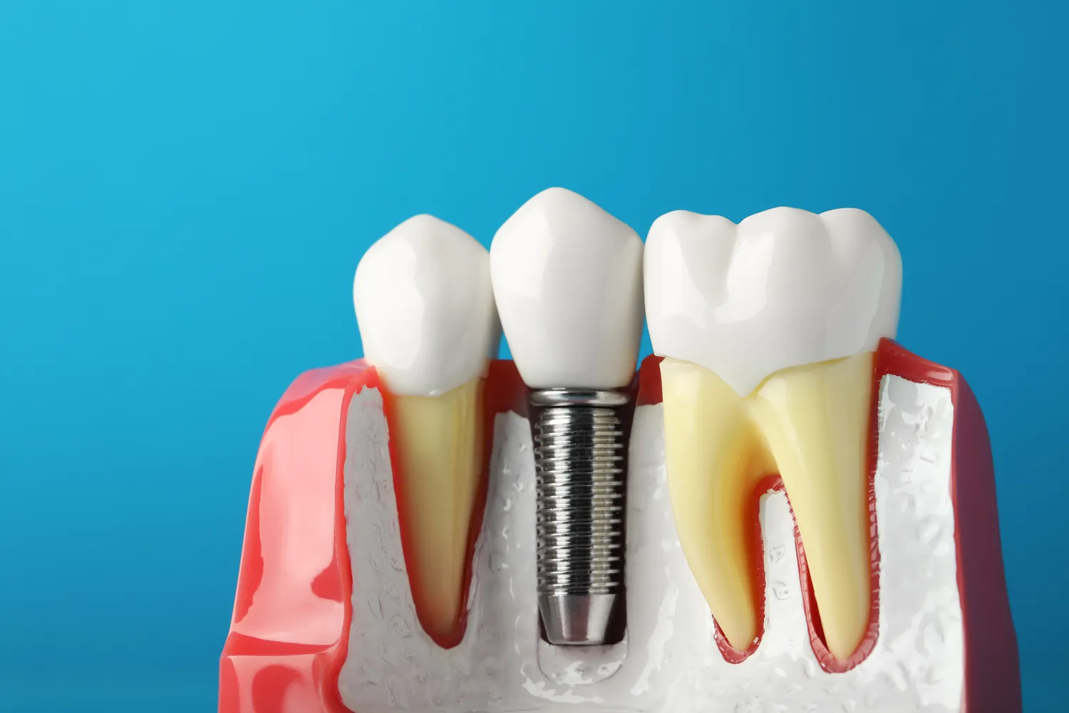 Wybór dobrego dentysty