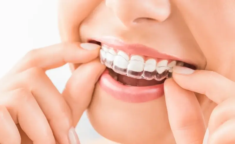 Dentysta - piękny uśmiech, białe zęby