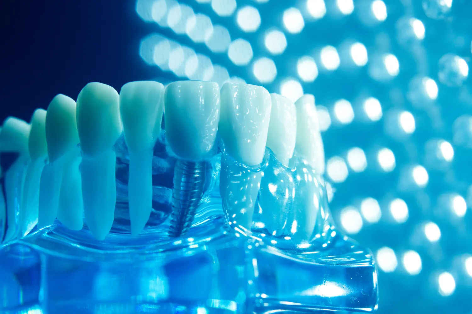 Leczenie kanałowe Szczecin gdzie najlepiej